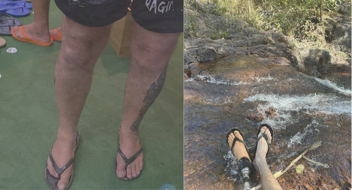 Slappas can be worn by people who have lost toes and amputees with prosthetic feet